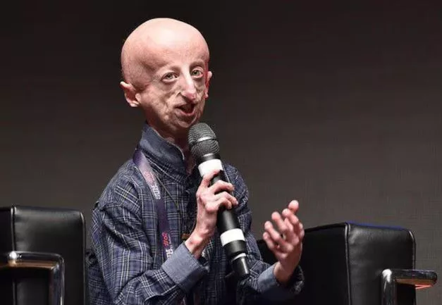 Progeria - Sammy Basso