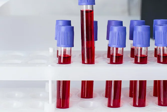 El profesor Hiromi Sakai, de la Universidad Médica de Nara, Japón lidera un equipo encargado de hacer estudios en muestras de sangre artificial que serán puestas a prueba, esto a través del método para desarrollar el líquido vital, que involucra la extracción de hemoglobina de células rojas derivadas de sangre vencida de donantes, para después contenerla en una cobertura protectora para crear células rojas estables y libres de virus.