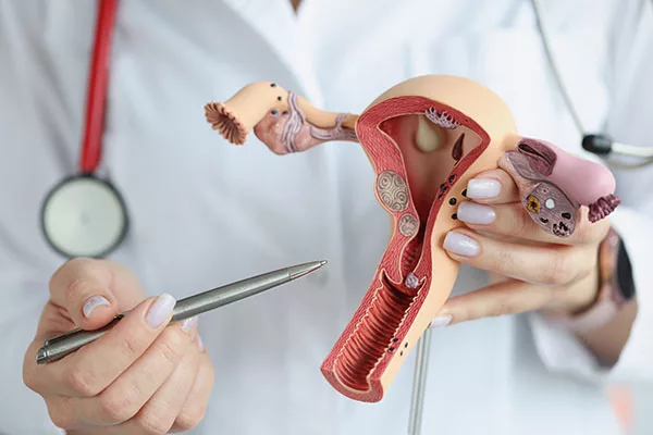 cáncer de ovarios