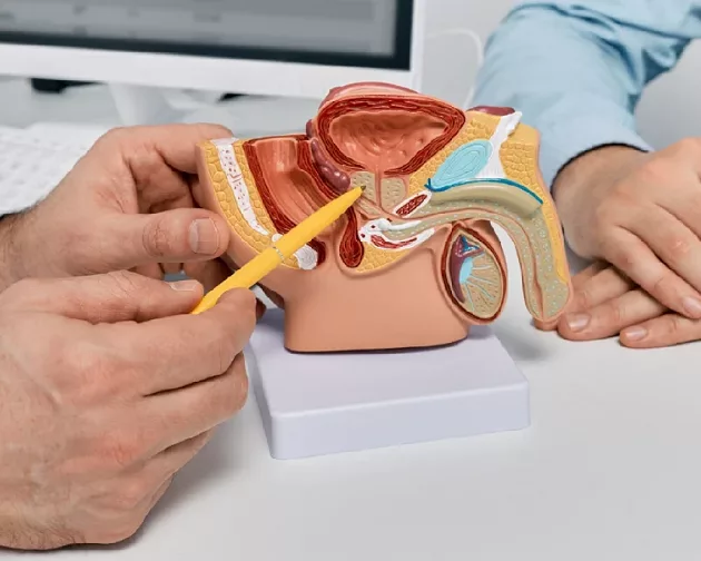 Cáncer de próstata