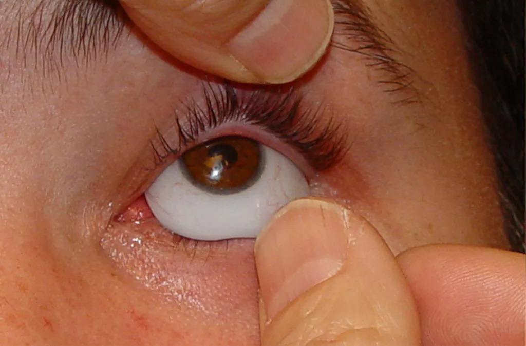 SLIDER protesis ocular 1