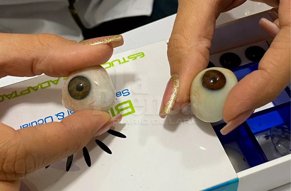 Prótesis ocular: más que por estética, mejora el autoestima