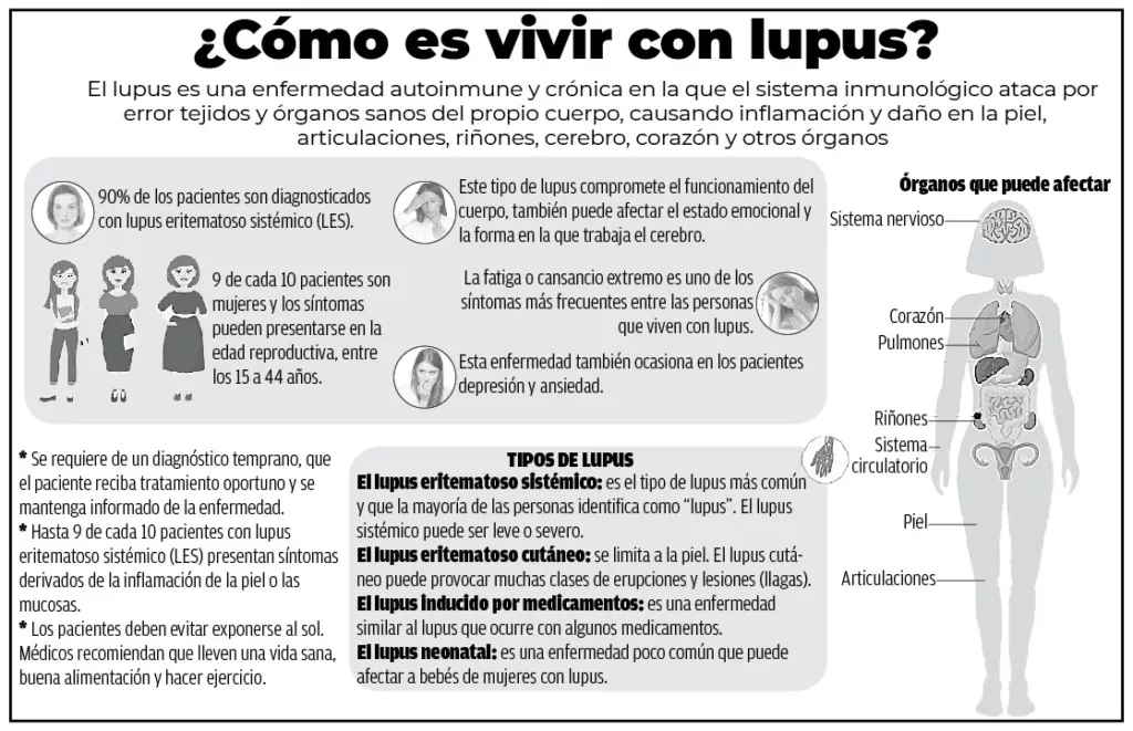 Lupus: una enfermedad que quiere que sus pacientes se vuelvan expertos de ella