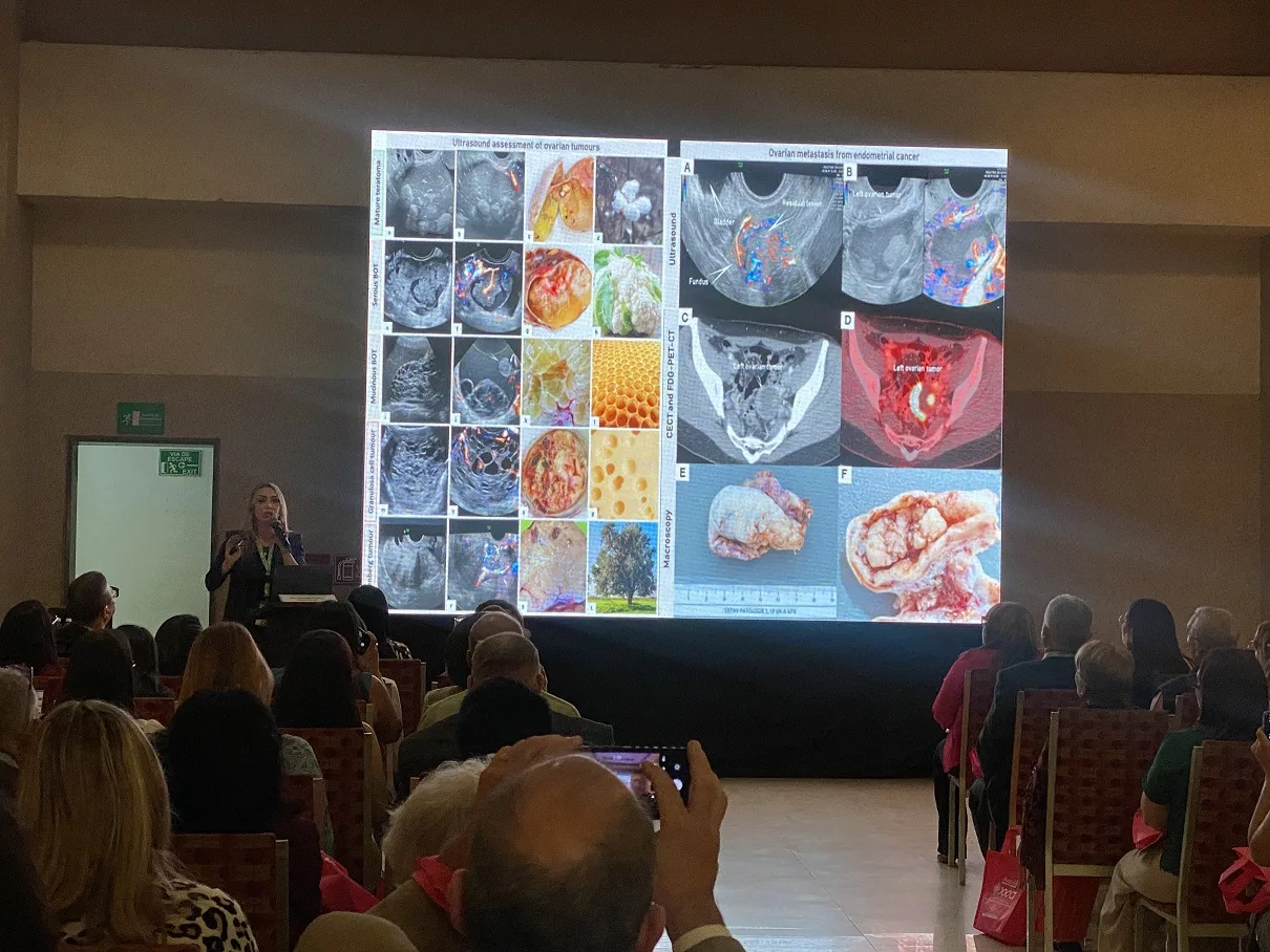 cáncer de cuello uterino