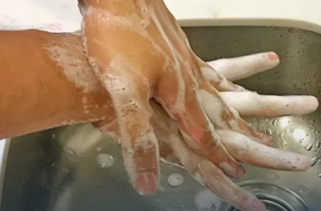 Especialistas advierten repunte de enfermedades respiratorias en Venezuela