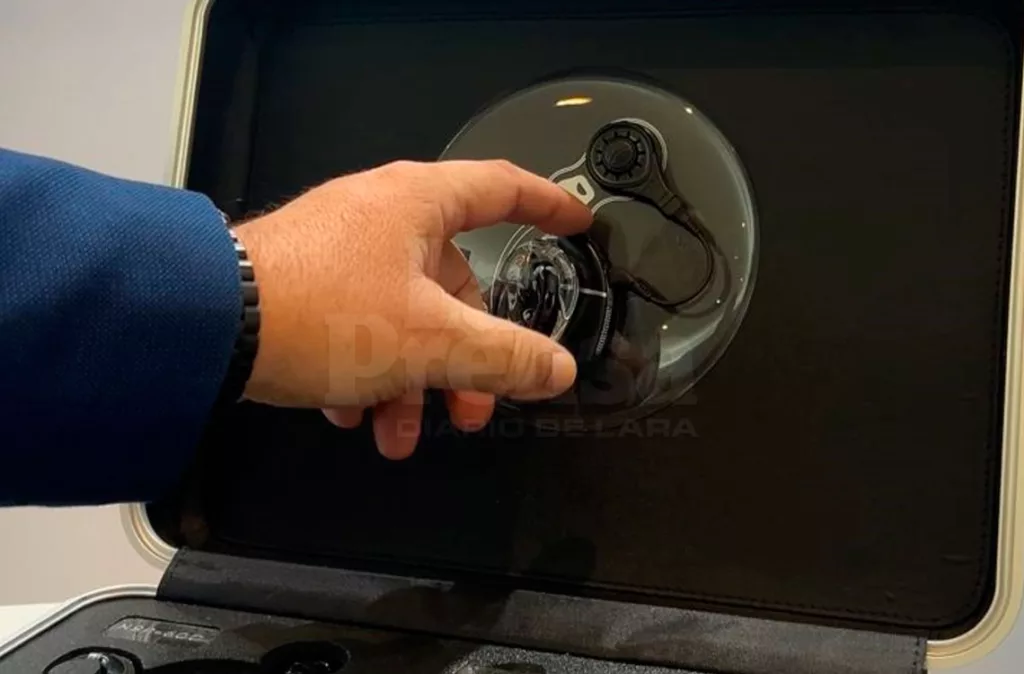 Lara encabeza la lista de los tres estados que realizan implantes cocleares