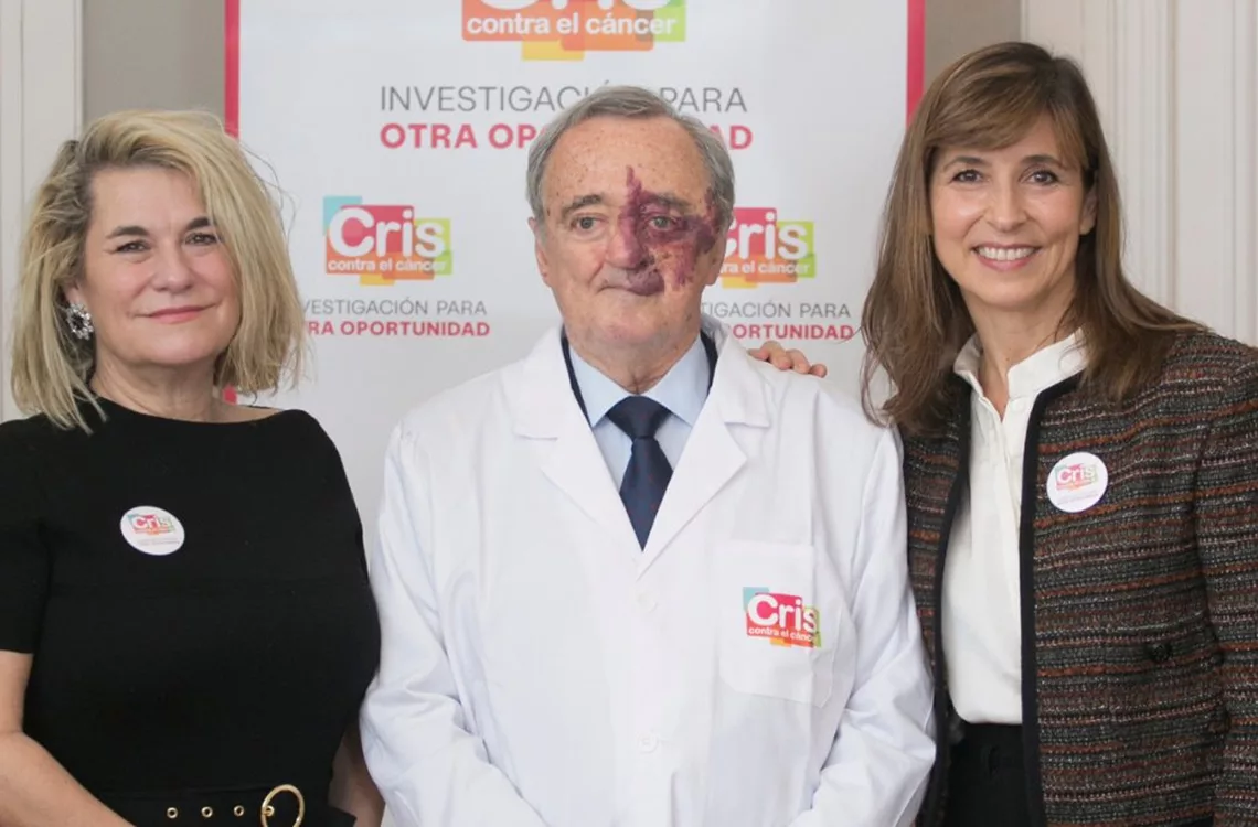 Barbacid logra erradicar el cáncer de páncreas en modelos experimentales