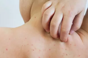 Venezuela enfrenta repunte de tres enfermedades