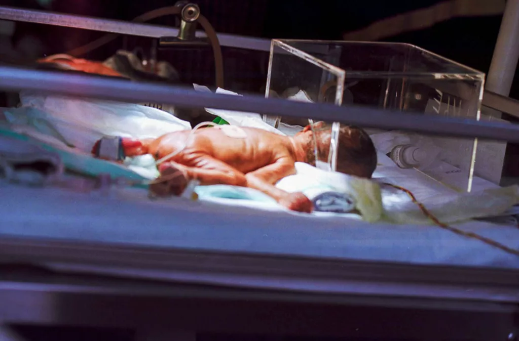 Sociedad de Obstetricia y Ginecología de Venezuela advierte 12% de incidencia de prematuridad