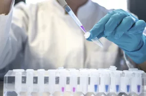Según Fecobiove, 81% de los laboratorios públicos en Venezuela están inoperativos