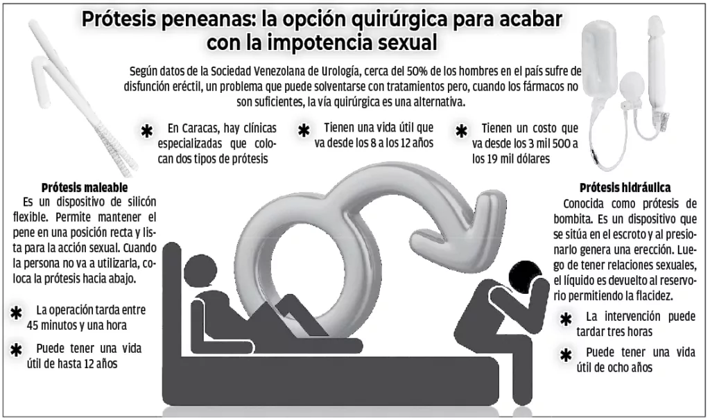 Prótesis de pene: una alternativa para la disfunción eréctil