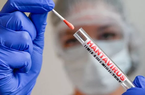 Academia Nacional de Medicina descarta riesgo inminente de hantavirus en Venezuela