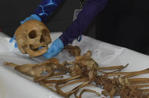 Lara sin antropólogos forenses ni laboratorios para atender casos complejos