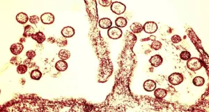 Hantavirus - OMS