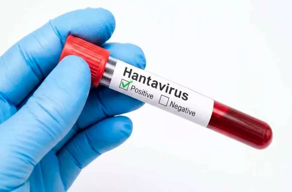 Hantavirus 223