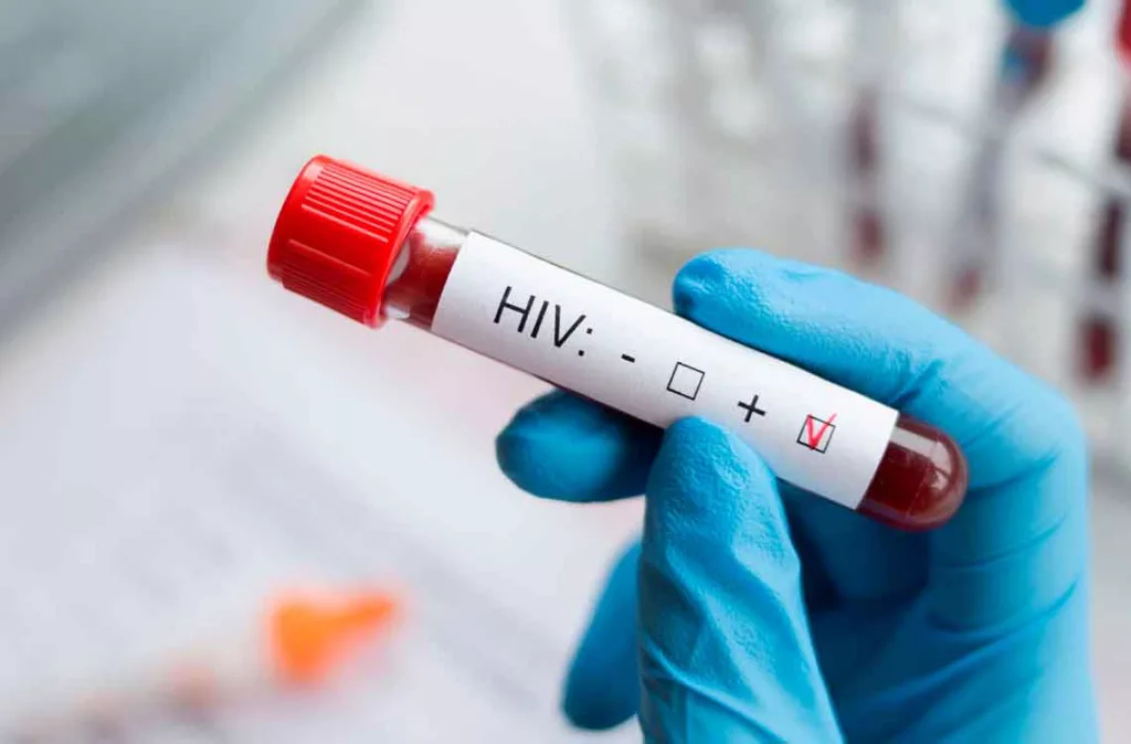 VIH/sida es una infección crónica sin cifras en el país